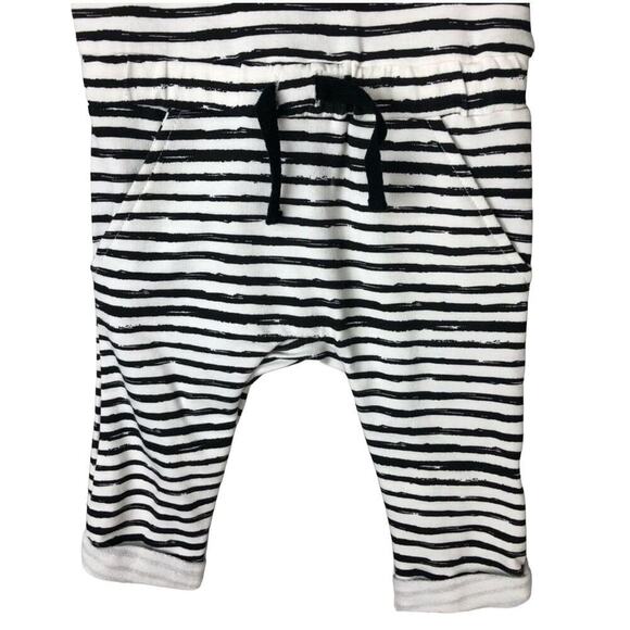 Focus Kids Black And White Striped Coverall and Pineapple Bib Set Size 3 Months - Picture 4 of 4